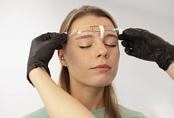 Диспорт в лоб и межбровье: коррекция морщин