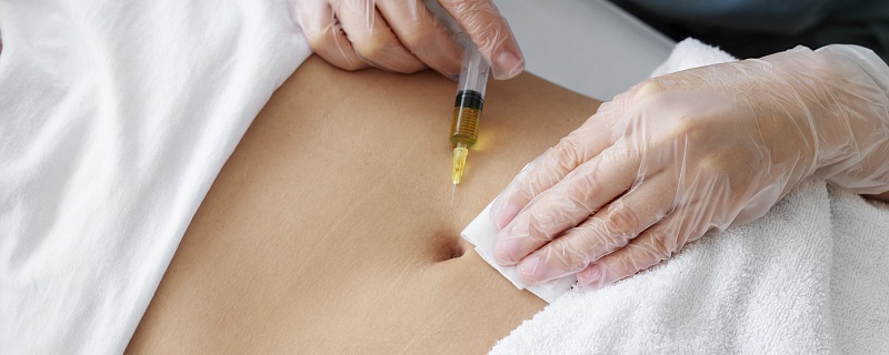 Криолиполиз: коррекция фигуры холодом