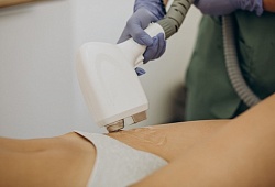 Курс лазерной эпиляции: сколько сеансов нужно для результата | Центр "Космос"