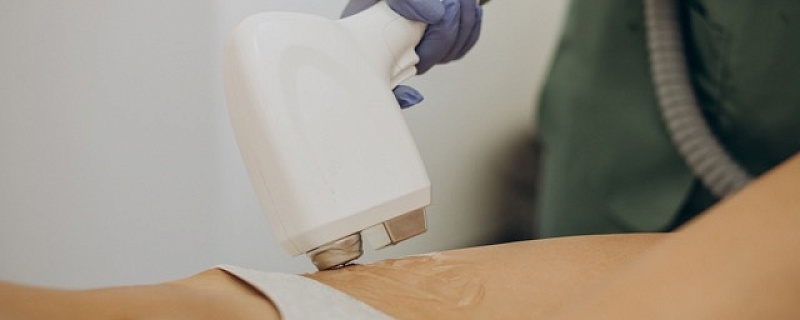 Курс лазерной эпиляции: сколько сеансов нужно для результата | Центр "Космос"