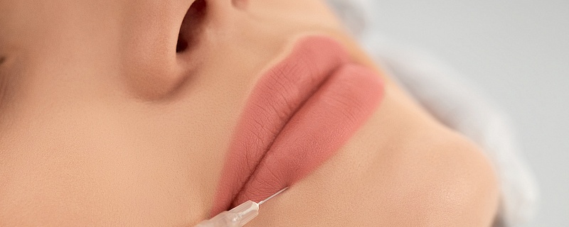 Увеличение губ гиалуроновой кислотой